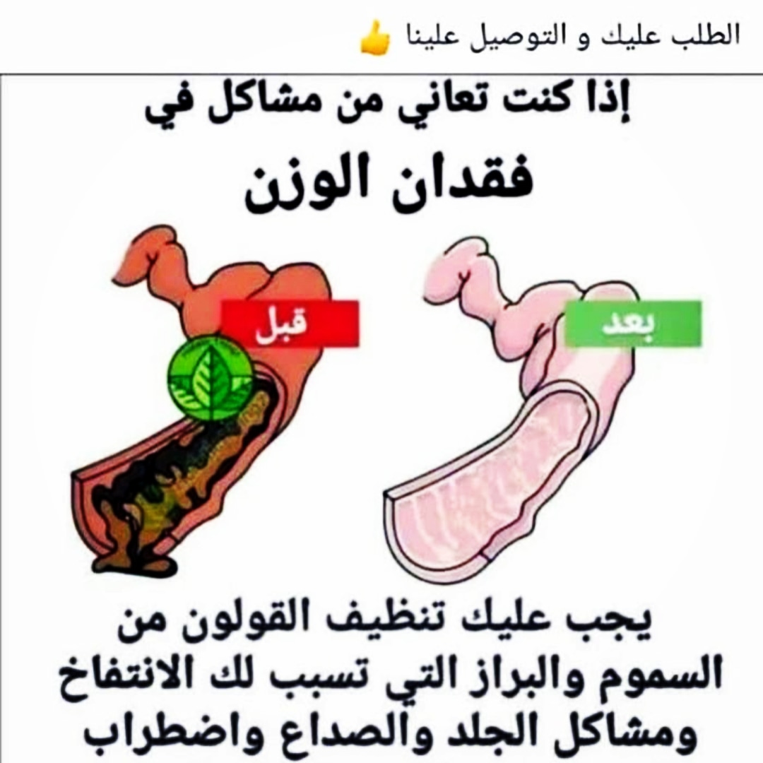 منتج طبيعي 