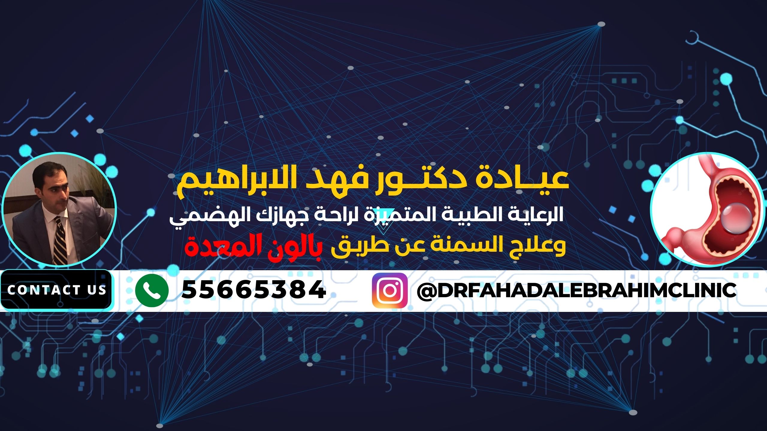 تركيب بالون المعدة في الكويت مع د. فهد الإبراهيم: الحل الآمن والفعّال لعلاج السمنة