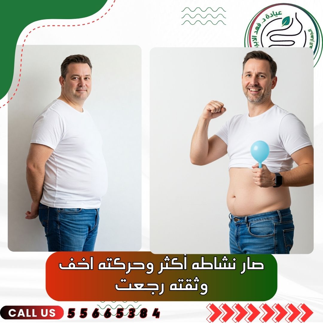 تركيب بالون المعدة مع د.فهد الإبراهيم الحل الآمن لخسارة الوزن بسرعة بدون جراحة وبدون ألم