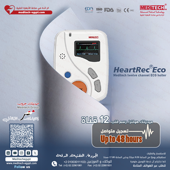 هولتر تسجيل 48 ساعه متواصل على مدار اليوم خلال الاعمال اليوميه و اثناء النوم